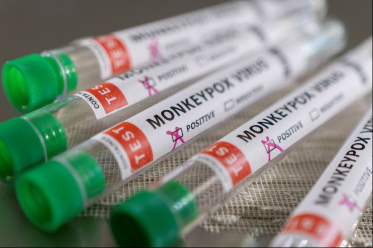 Foto de apoio ilustrativo. O Ceará tem 587 confirmações de monkeypox, renomeada oficialmente como "Mpox" pela Organização Mundial da Saúde (OMS), nesta segunda-feira, 28