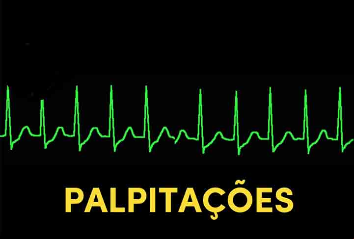É preciso destacar que boa parte das arritmias não tem uma causa bem definida, sendo algumas de nascença. Outras são em virtude de problemas no músculo do coração, como infarto, insuficiência cardíaca ou doença de Chagas.